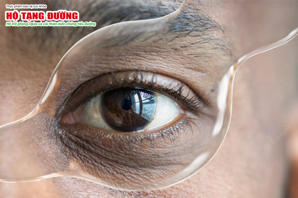 Suy giảm thị giác là biến chứng của tiểu đường giai đoạn cuối